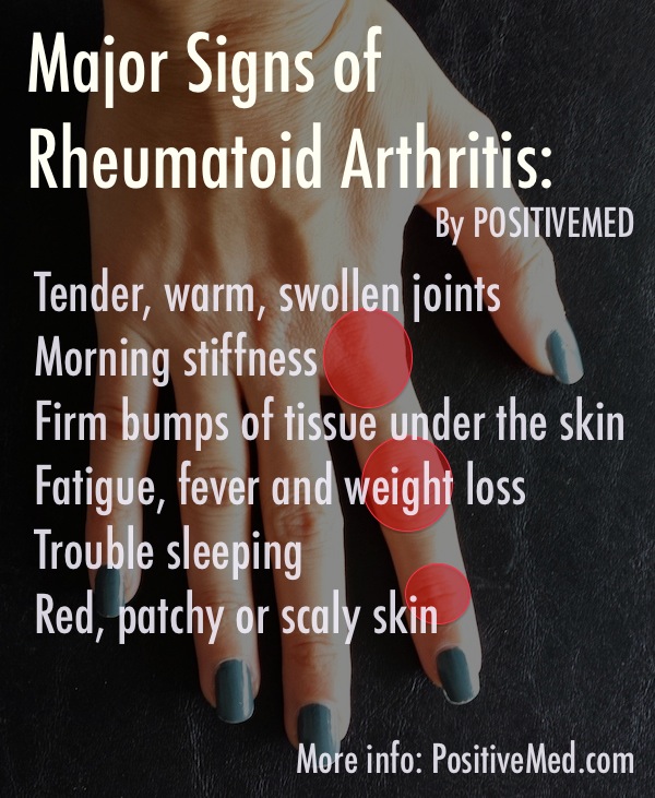 signs of rheumatoid arthritis
