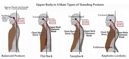 weak upper back muscles