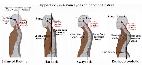 weak-upper-back-muscles-positivemed