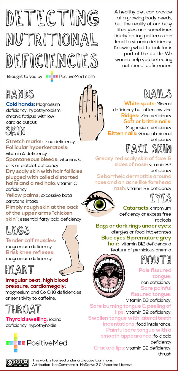 detecting-nutritional-deficiencies