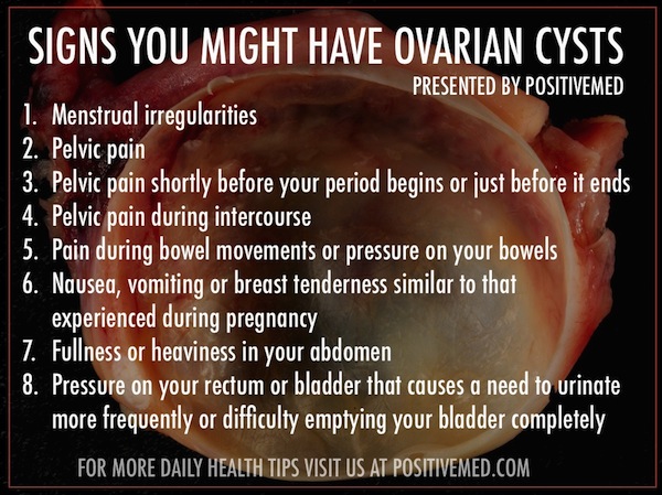 ovarian cysts symptoms