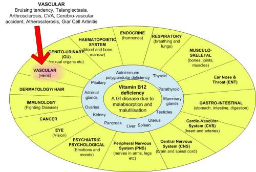 What You Should Know About Vitamin B12 and Warning Signs Of Vitamin B12 Deficiency 1