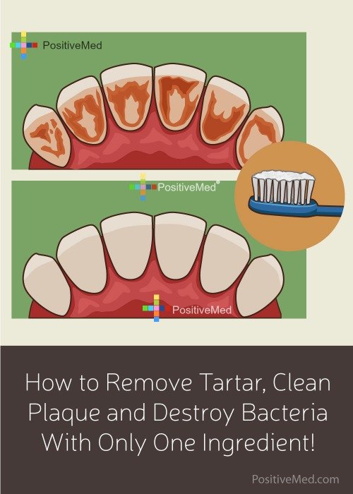 How to Remove Tartar, Clean Plaque and Destroy Bacteria With Only One Ingredient!