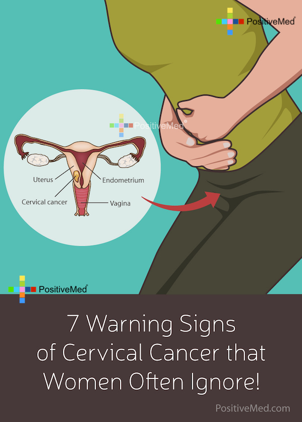 7 Warning Signs of Cervical Cancer that Women Often Ignore!