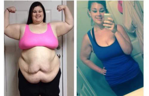 She Weighed Over 400 Pounds! It Took Her 15 Month To Look Like She Looks Now