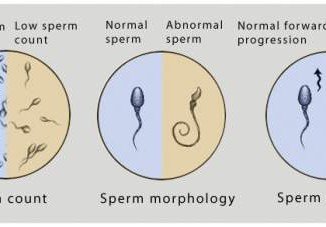terminology Sperm count