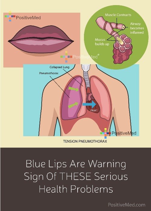 Blue Lips Are Warning Sign Of THESE Serious Health Problems