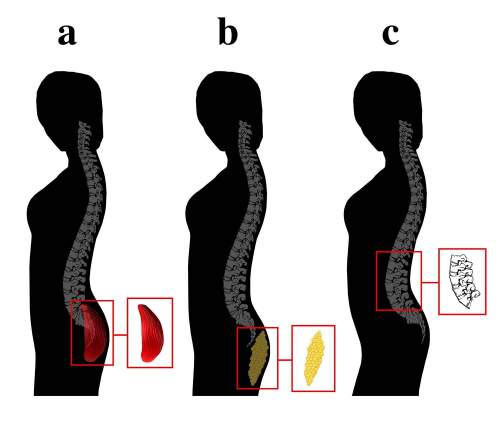 Spine-Curves.jpg (500×430)