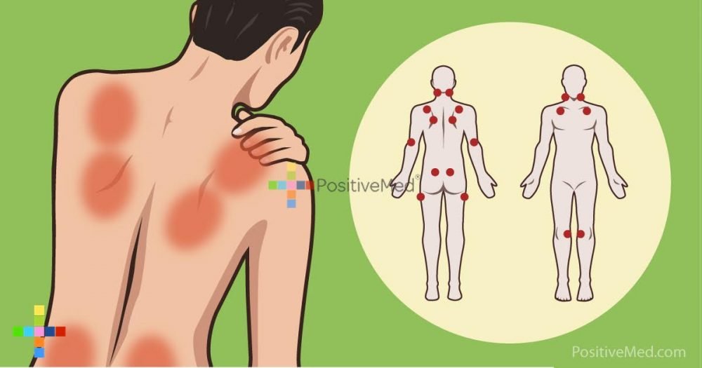 study-linked-this-common-vitamin-deficiency-to-your-joint-and-back-pain