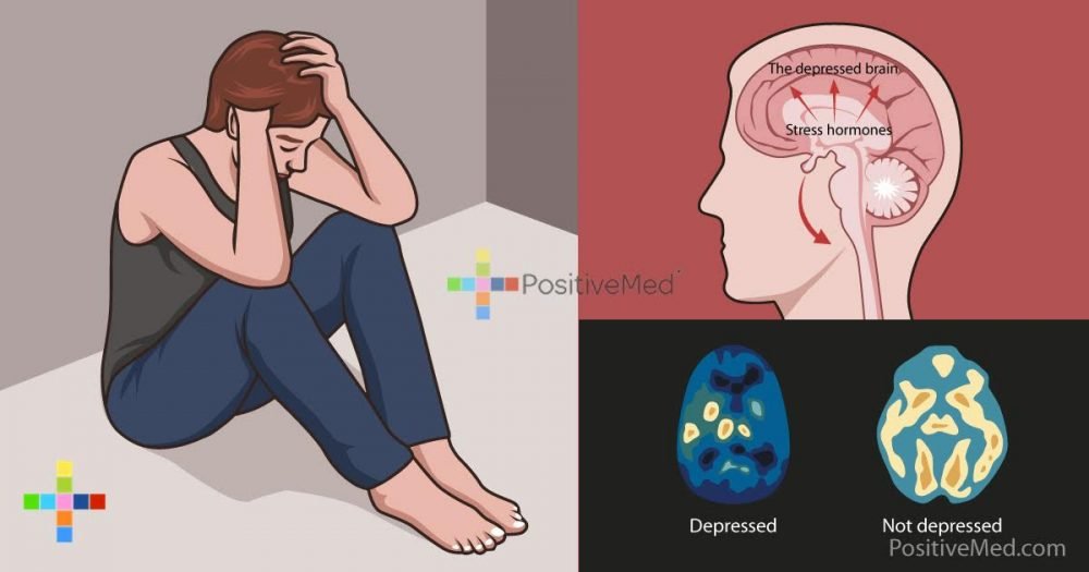 this-is-what-happens-to-your-brain-and-memory-when-youre-depressed