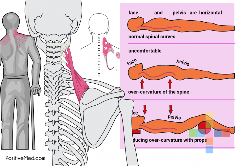 Simple Trick To Get Rid Of Your Stiff Neck In 10 Seconds PositiveMed