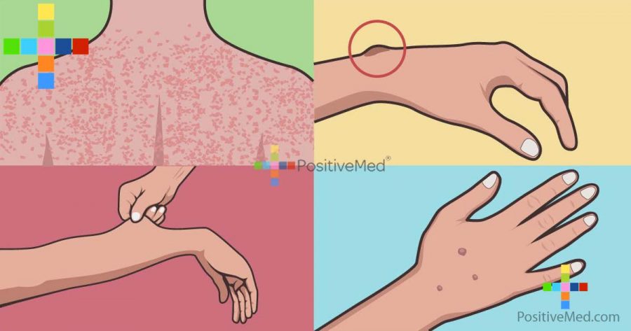 your-skin-problems-could-indicate-internal-cancer-heres-what-you-need-to-know