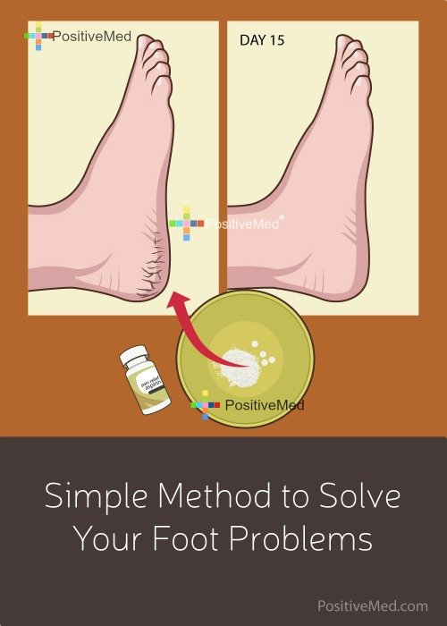 Simple Method to Solve Your Foot Problems