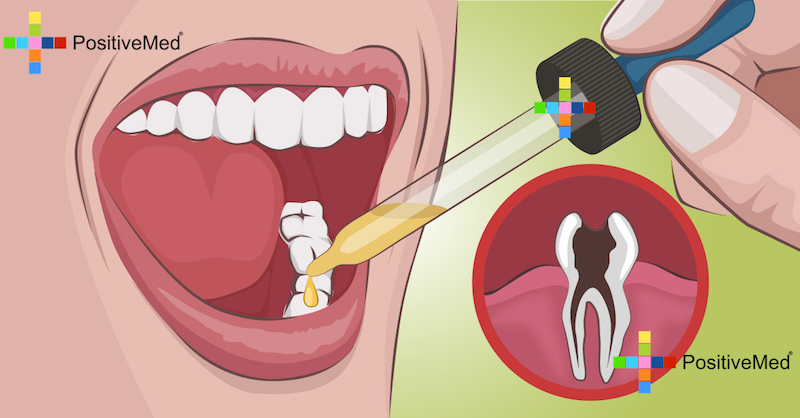 here-s-how-to-cure-your-toothache-in-literally-seconds-you-can-thank