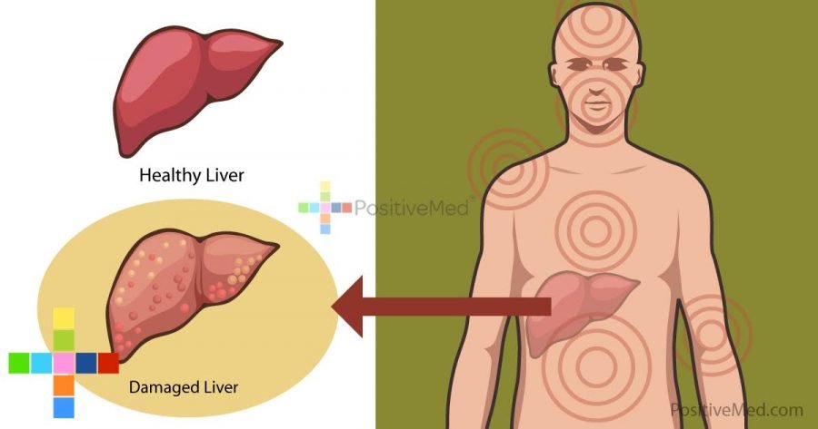 12-body-signals-about-liver-damage