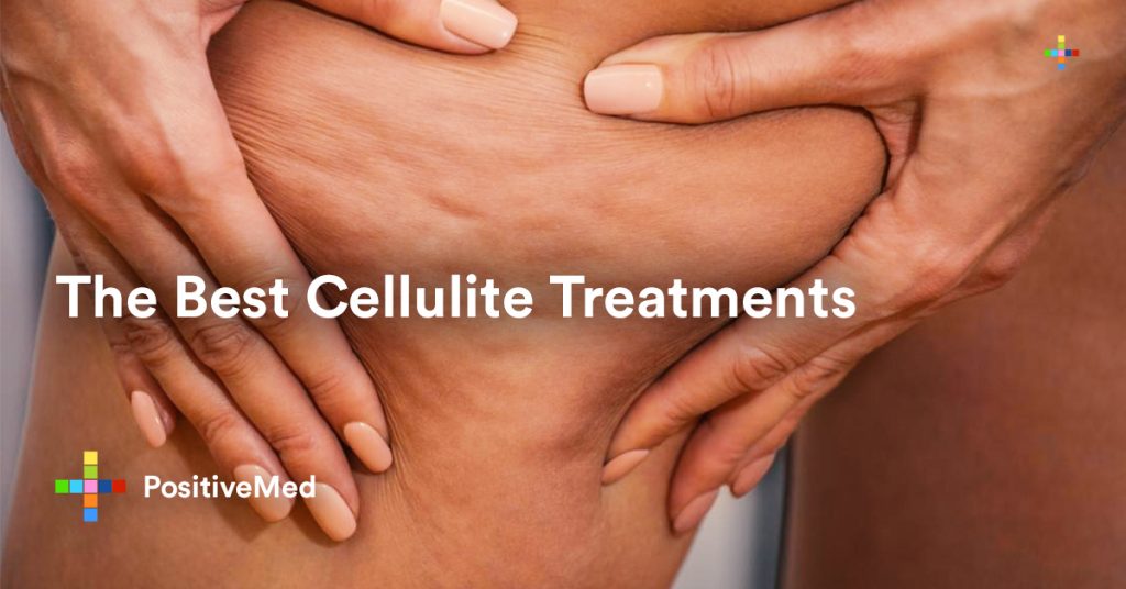 The Best Cellulite Treatments