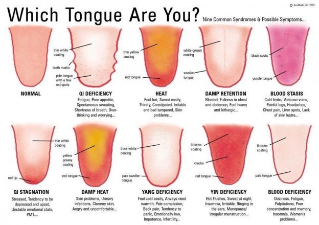 how-does-your-tongue-look-positivemed