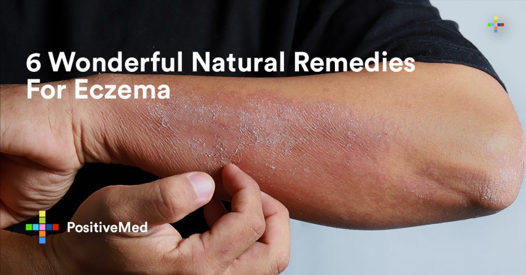 6 Wonderful Natural Remedies For Eczema.