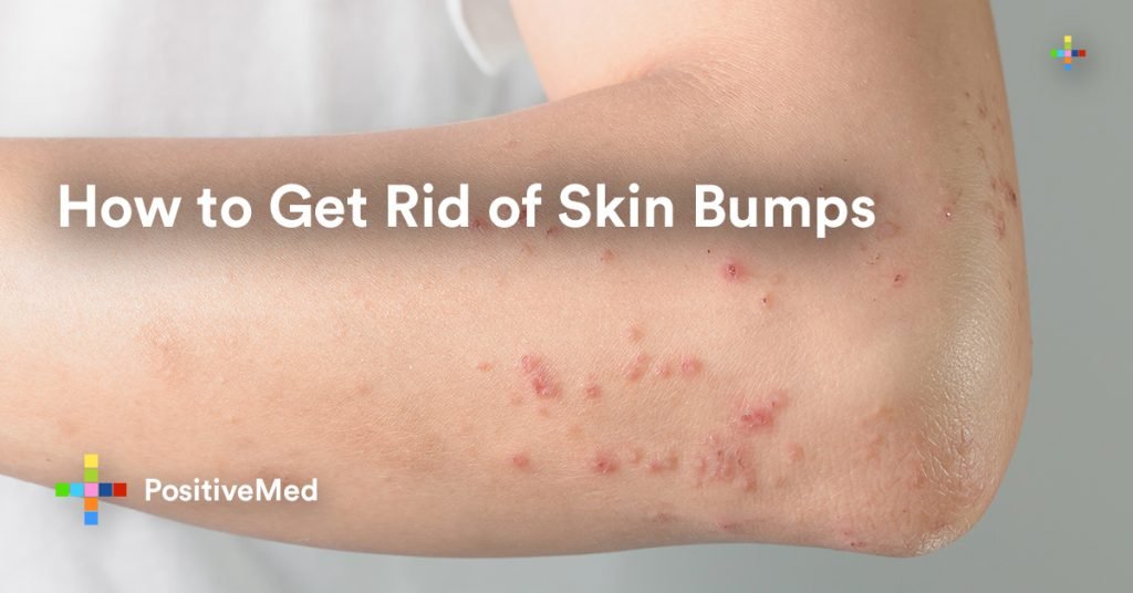 How To Get Rid Of Skin Bumps On Legs