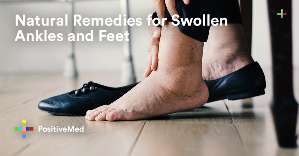 Natural Remedies for Swollen Ankles and Feet.