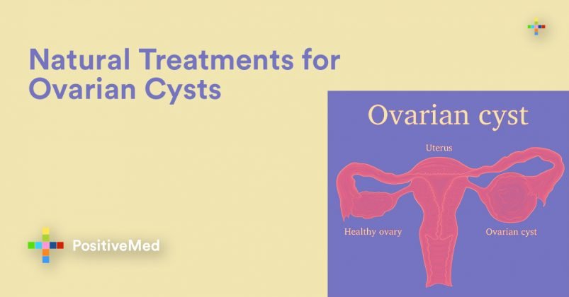 Natural Treatments For Ovarian Cysts