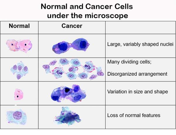 cancer_cells__1438449436_174.141.155.106