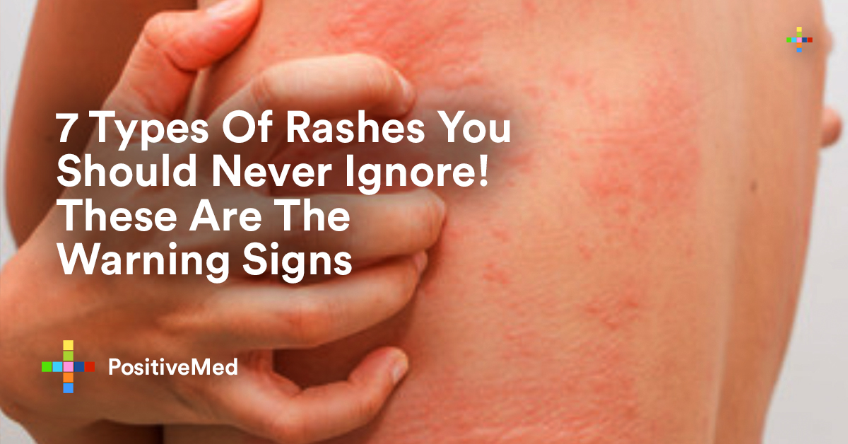 7 Types of Rashes You Should Never Ignore These Are The