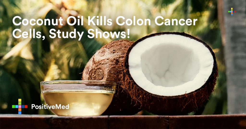 Coconut Oil Kills Colon Cancer Cells Study Shows