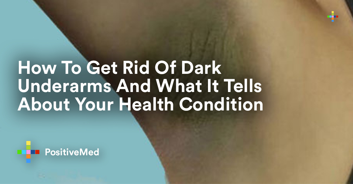 How To Get Rid Of Dark Underarms And What It Tells About Your Health Condition