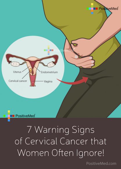 7 Warning Signs of Cervical Cancer that Women Often Ignore!