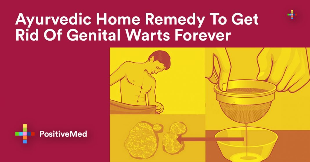 Ayurvedic Home Remedy To Get Rid Of Genital Warts Forever 0283