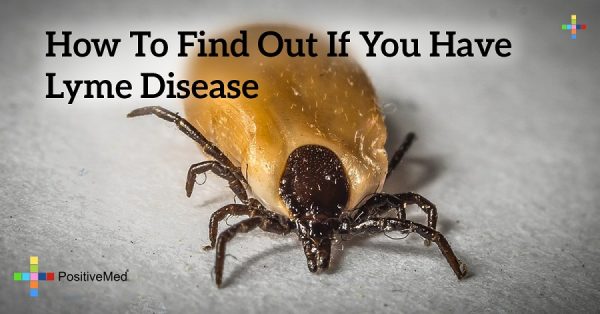 How to Find Out if You Have Lyme Disease - PositiveMed