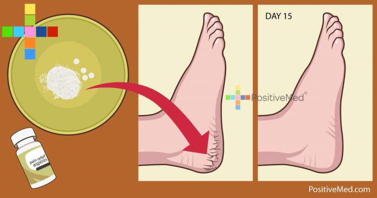 1 Simple Method to Solve Your Foot Problems