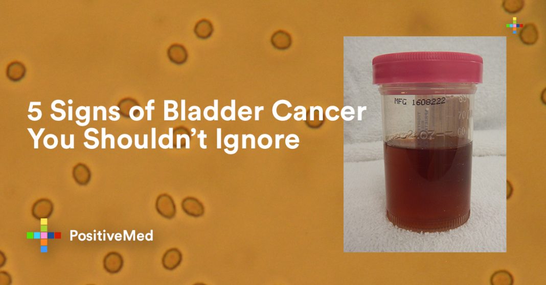 5-signs-of-bladder-cancer-you-shouldn-t-ignore-positivemed