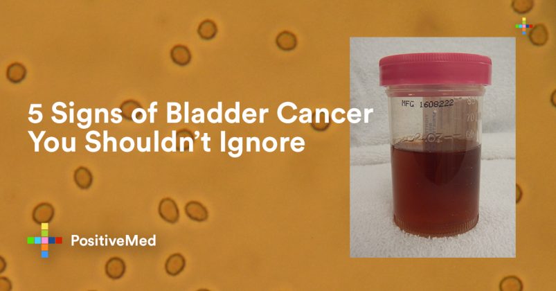 is bladder cancer curable