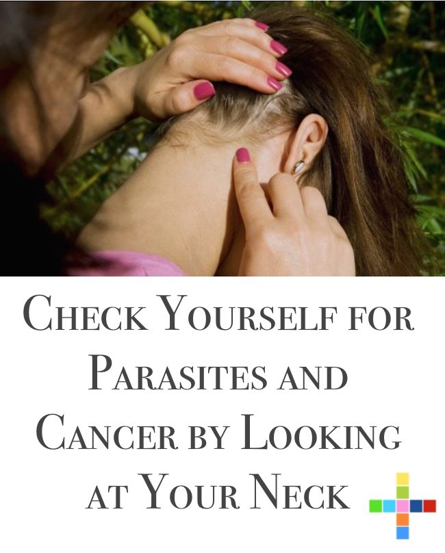 Check Yourself for Parasites and Cancer by Looking at Your Neck