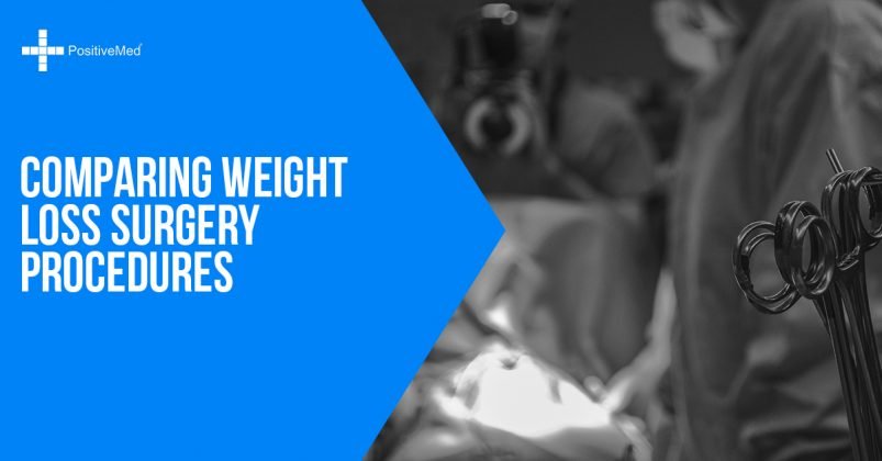 Comparing Weight Loss Surgery Procedures - PositiveMed