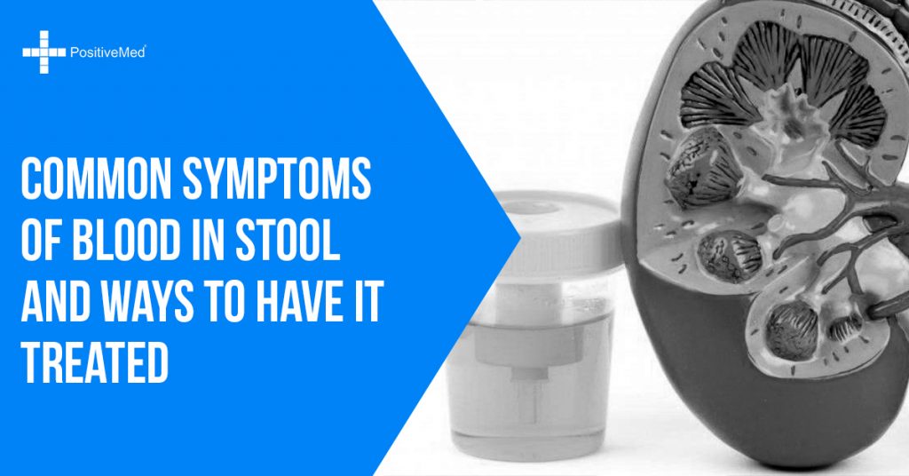 Common Symptoms of Blood in Stool and Ways to Have it Treated
