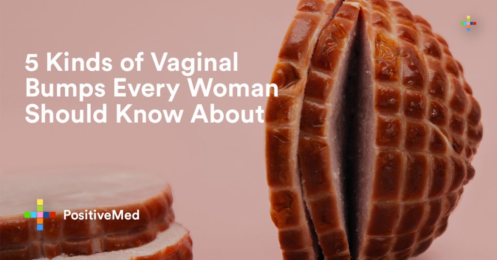 vaginal-bumps-every-woman-should-know-about