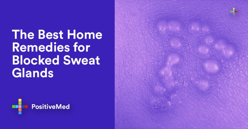 the-best-home-remedies-for-blocked-sweat-glands