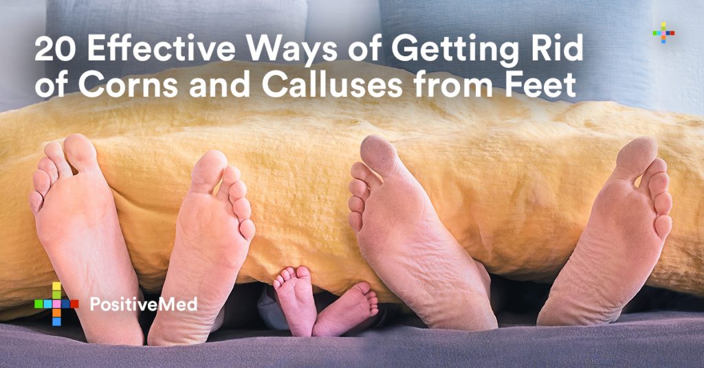 20 Effective Ways of Getting Rid of Corns and Calluses from Feet