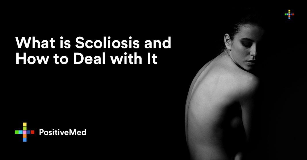 What Is Scoliosis And How To Deal With It