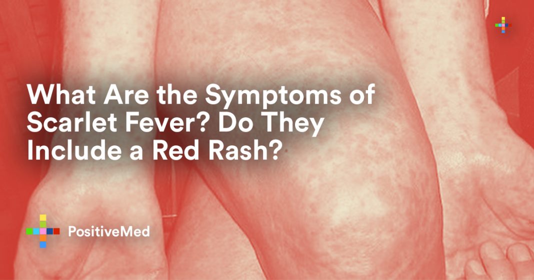 signs-and-symptoms-of-scarlet-fever