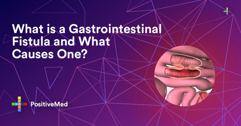 What is a Gastrointestinal Fistula and What Causes One? - PositiveMed