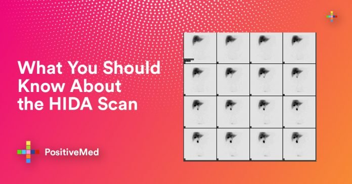 What You Should Know About the HIDA Scan - PositiveMed