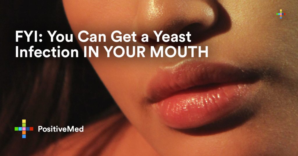 Can You Get a Yeast Infection in Your Mouth? - PositiveMed