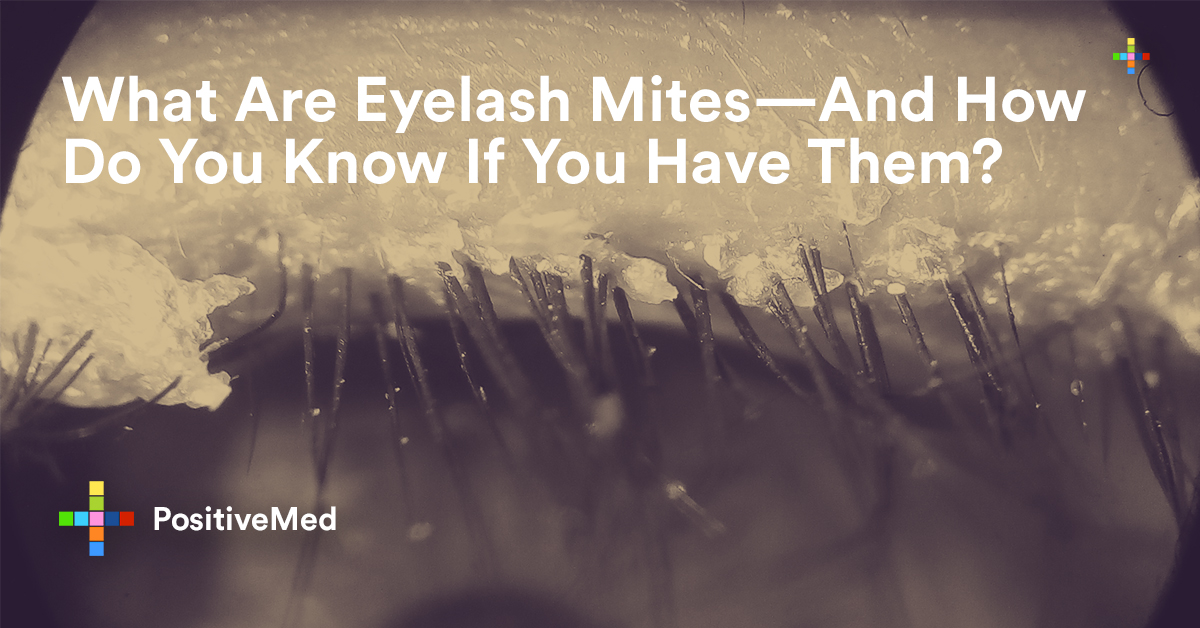 What Are Eyelash Mites—and How Do You Know If You Have Them 