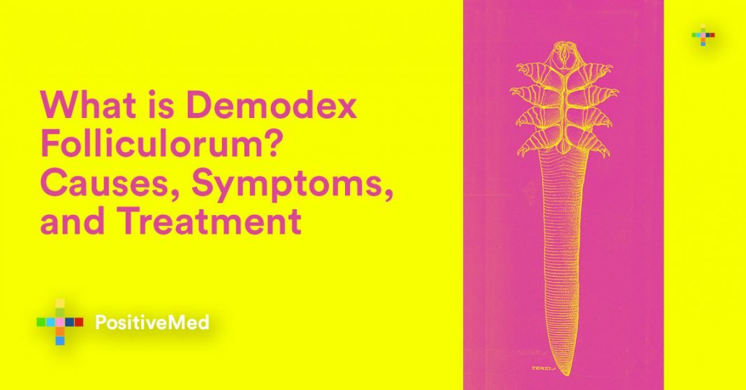 What Is Demodex Folliculorum Causes Symptoms And Treatment 