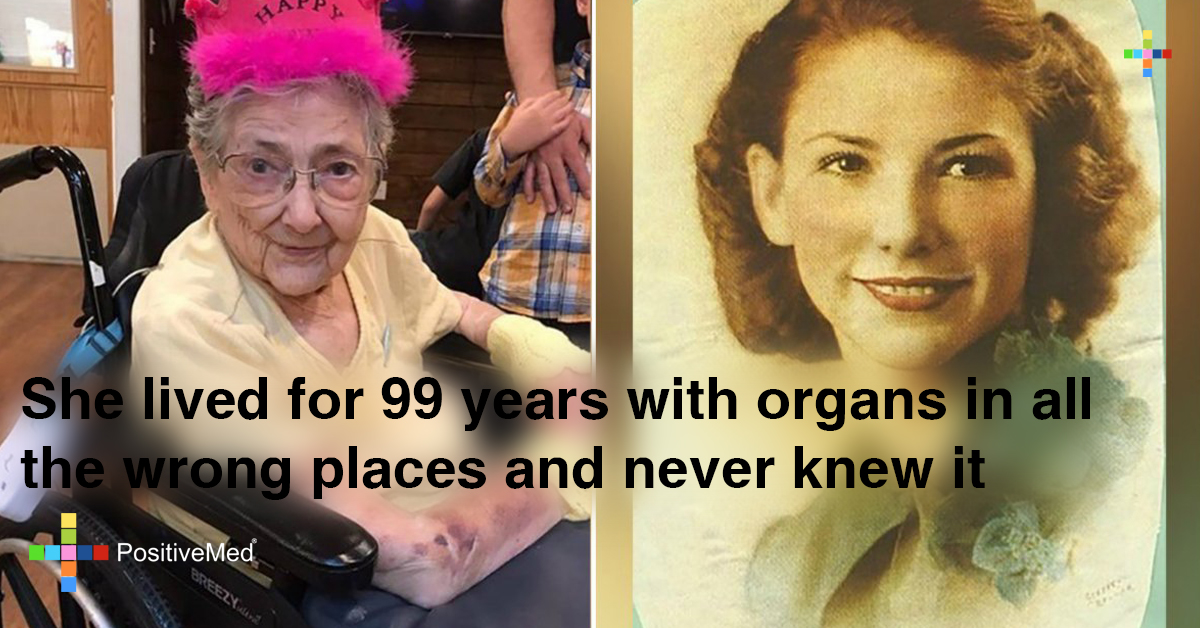 She Lived for 99 Years with Organs in all the Wrong Places and Never Knew it                                                  