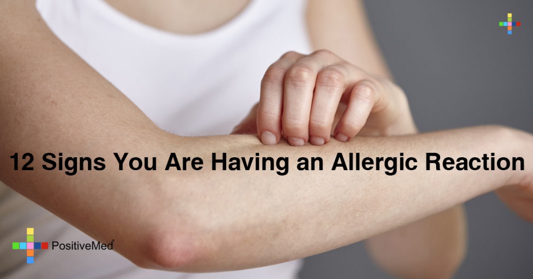 12-signs-you-are-having-an-allergic-reaction-positivemed